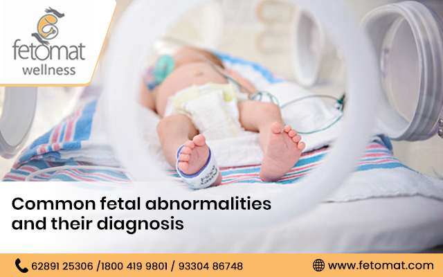 Common Fetal Abnormalities and their Diagnosis