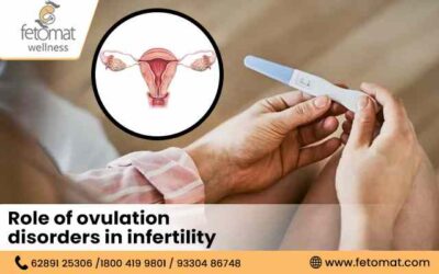 Role of Ovulation Disorders in Infertility