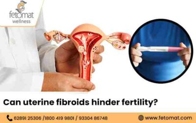 Can Uterine Fibroids Hinder Fertility?
