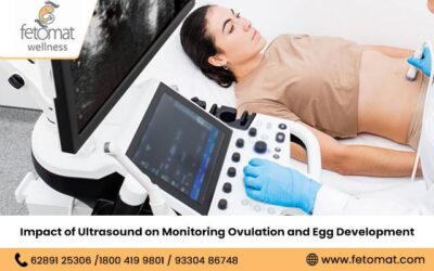 Impact of Ultrasound on Monitoring Ovulation and Egg Development