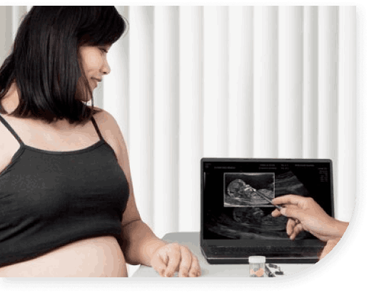 volume-4d-ultrasound-in-pregnancy